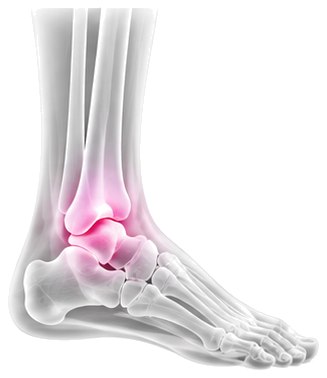 X-ray style view of the ankle