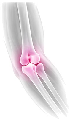 X-ray style view of the elbow