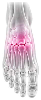 X-ray style view of the foot
