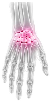 X-ray style view of the wrist